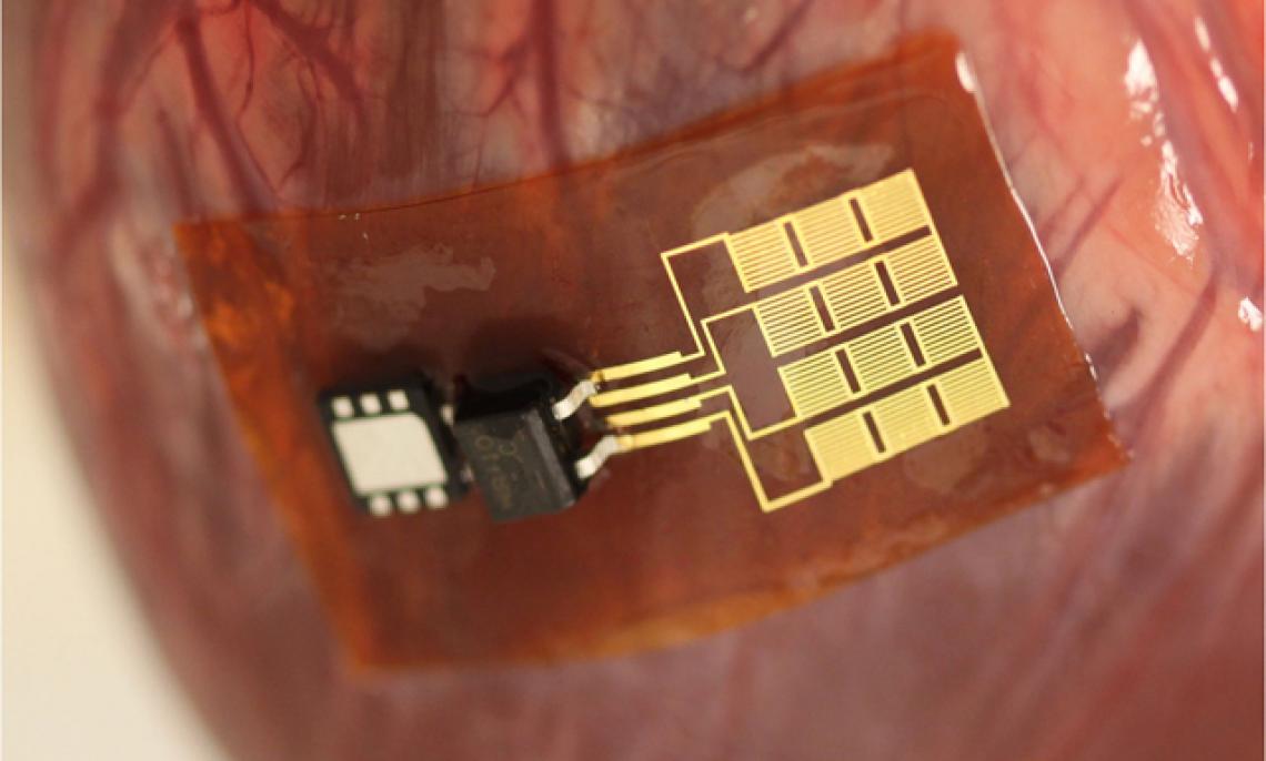 The mechanical energy harvester, which is flexible enough to conform to the surface of an organ such as the heart, converts the organ's motion into electricity.